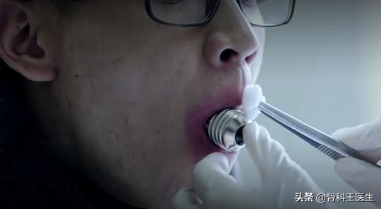 医院取出来的异物怎么处理,医生取眼里异物用的什么针