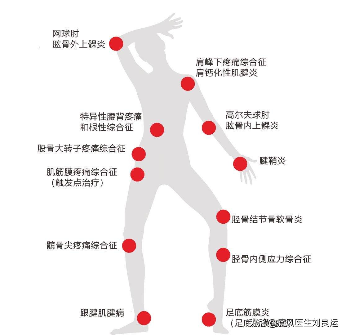 脚很痛不知道是扭伤还是痛风,脚痛不肿怎么判断是不是痛风