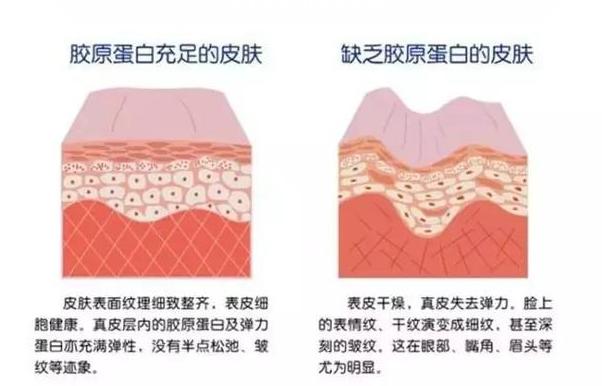 女人法令纹怎么改善,女生长法令纹怎么安慰