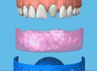 延禧攻略美容仪,延禧攻略给女人的忠告