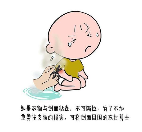 孩子烫伤10小时后起泡,孩子烫伤后多久没有痛感