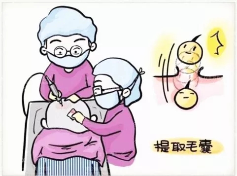 什么会促进毛囊生长,什么能影响毛囊