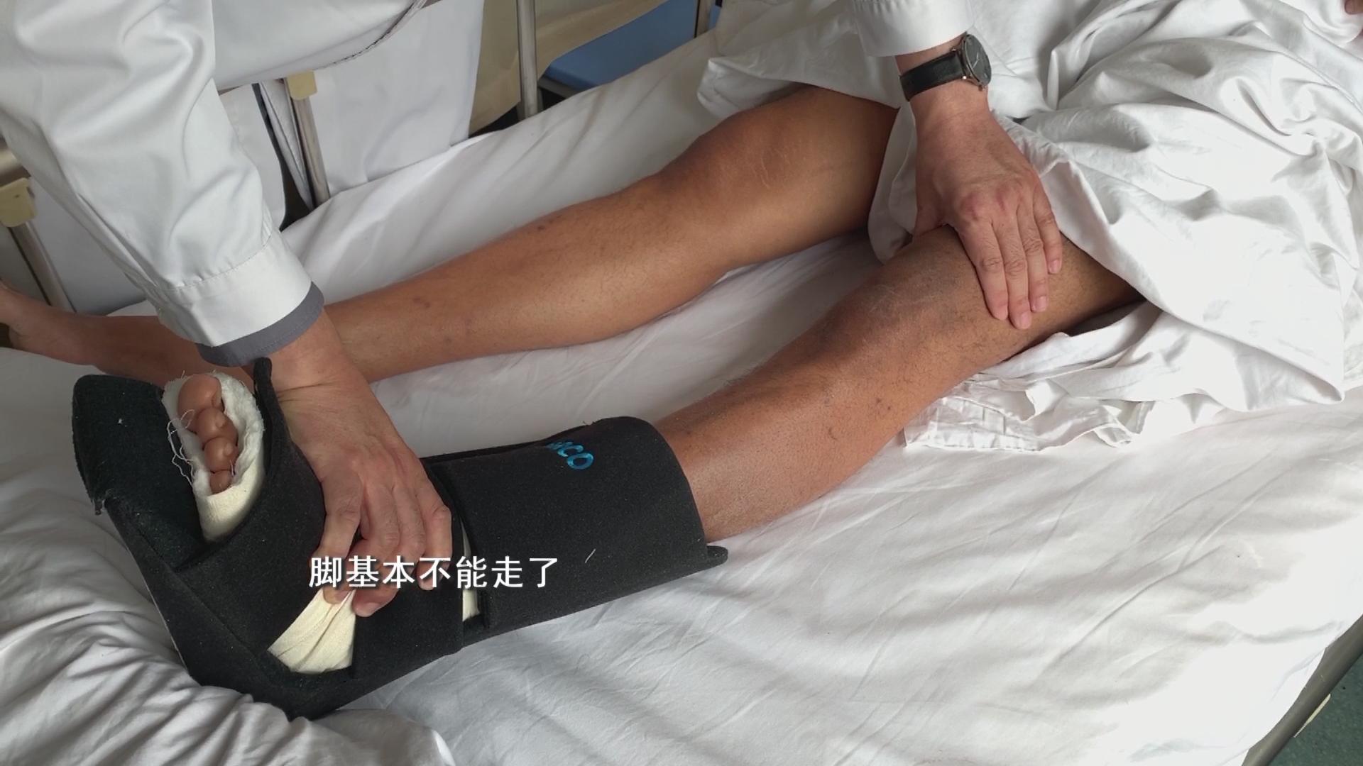 沈阳小伙小拇指骨折,沈阳小伙崴脚