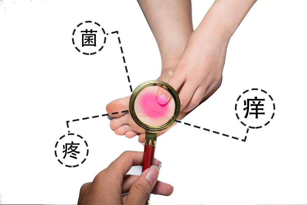 脚总是很臭是脚气吗,脚臭可能因为什么