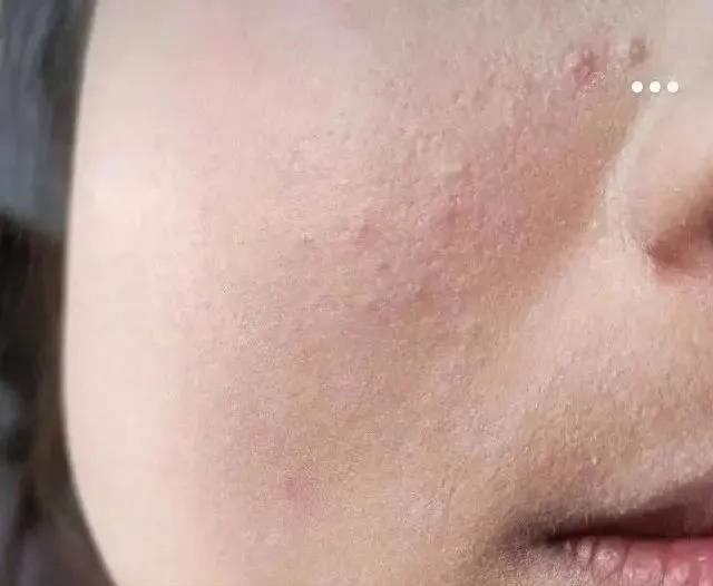 在空调屋里皮肤干燥、瘙痒、泛红，我来帮你解决