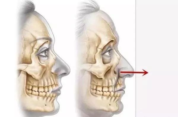 对付脸垮和法令纹，我颇有点研究心得