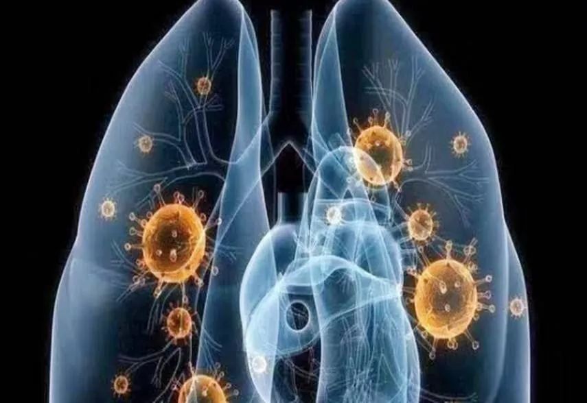 新冠肺炎免疫力,新冠肺炎患者缺乏四种益生菌