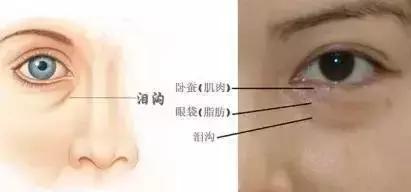 怎么化妆把眼睛变大,怎样化妆才能把眼睛画得大