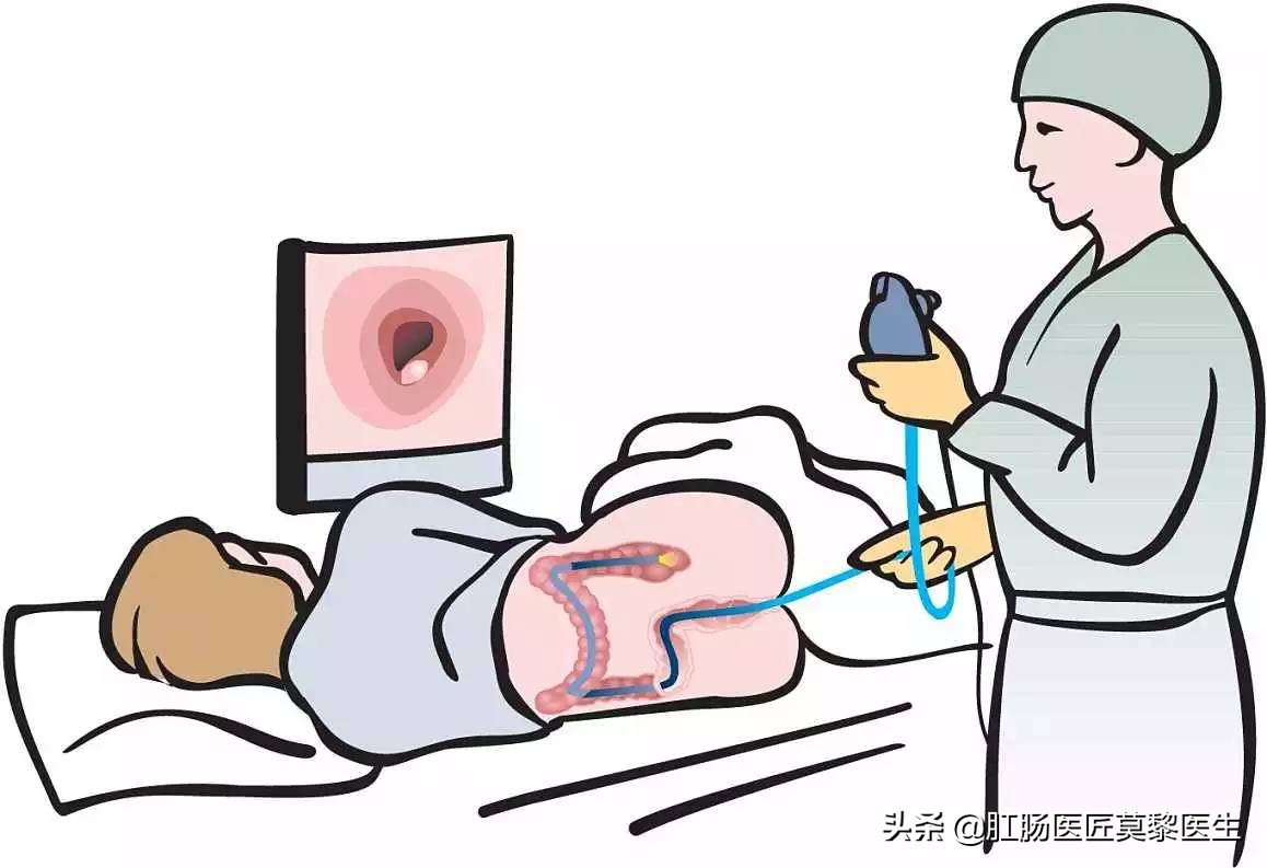 做完肠镜摘除息肉七天后腹部痛,肠镜息肉切除肚子要痛多长时间