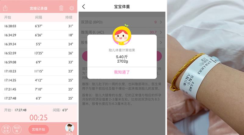 熊猫血妈妈产检,怀孕妈妈的艰难生产过程