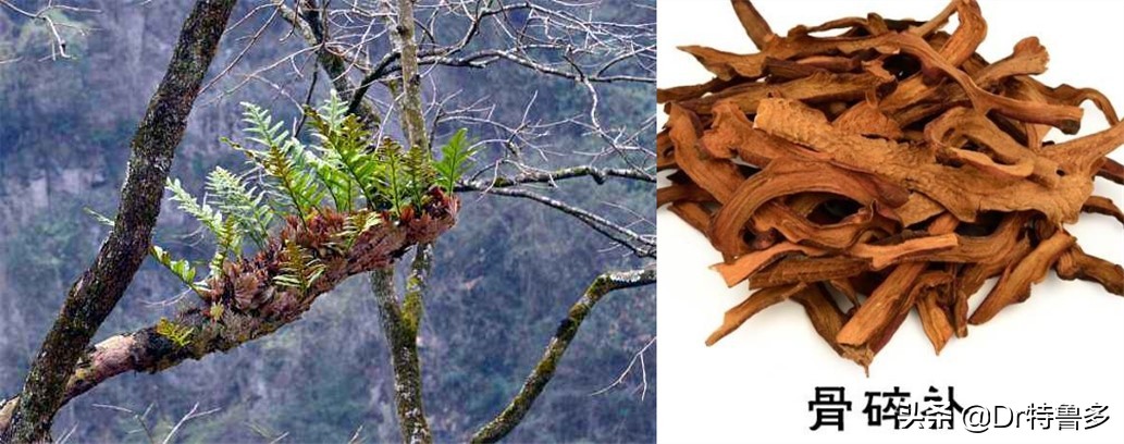 骨折中医和西医的意见不一样,骨折愈合中医西医一个不能少