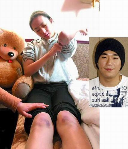 张默家暴事件完整版,张默与童瑶谈了几年恋爱