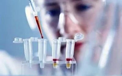 急性胰腺炎引起血淀粉酶升高原因,急性胰腺炎血淀粉酶高是怎么回事