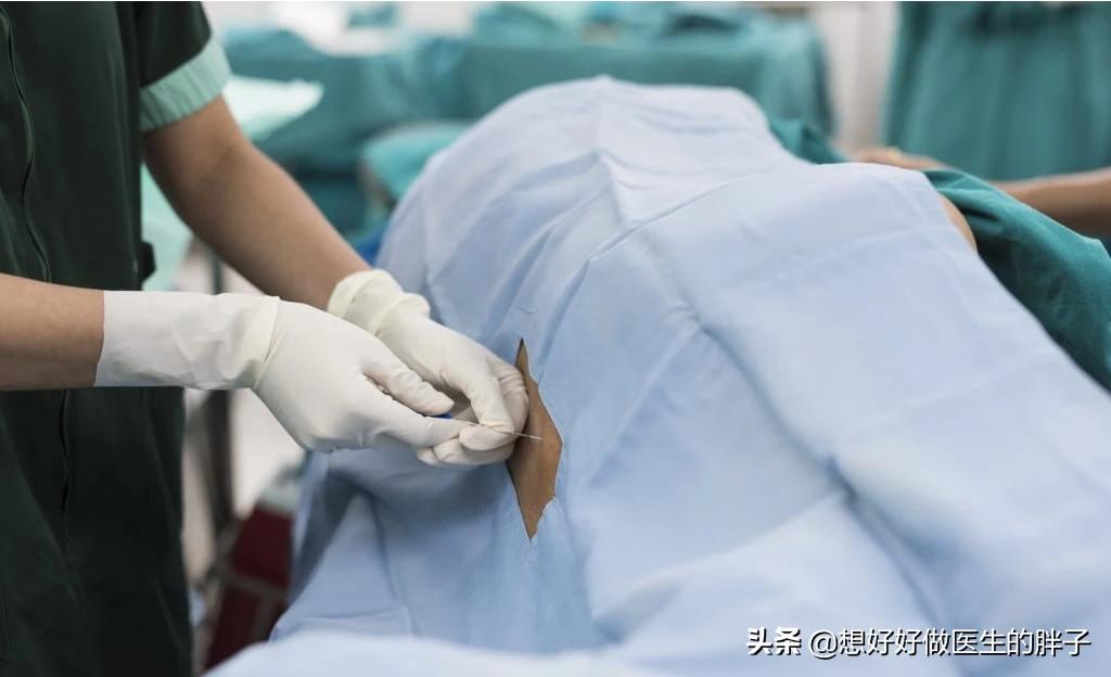 髓核游离型椎间盘突出,腰椎间盘突出髓核脱出症状