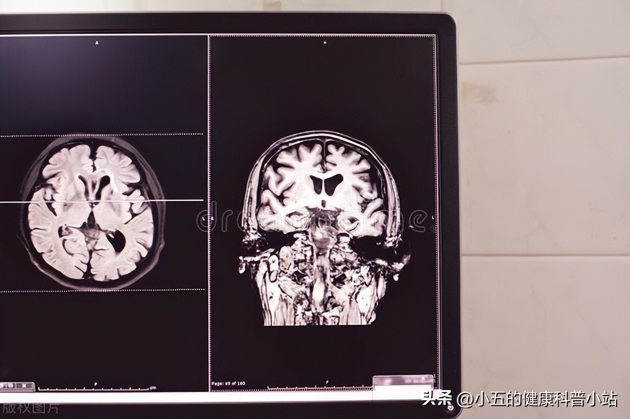 可以长期吃维b6吗,维生素b12和维生素b6能长期吃吗