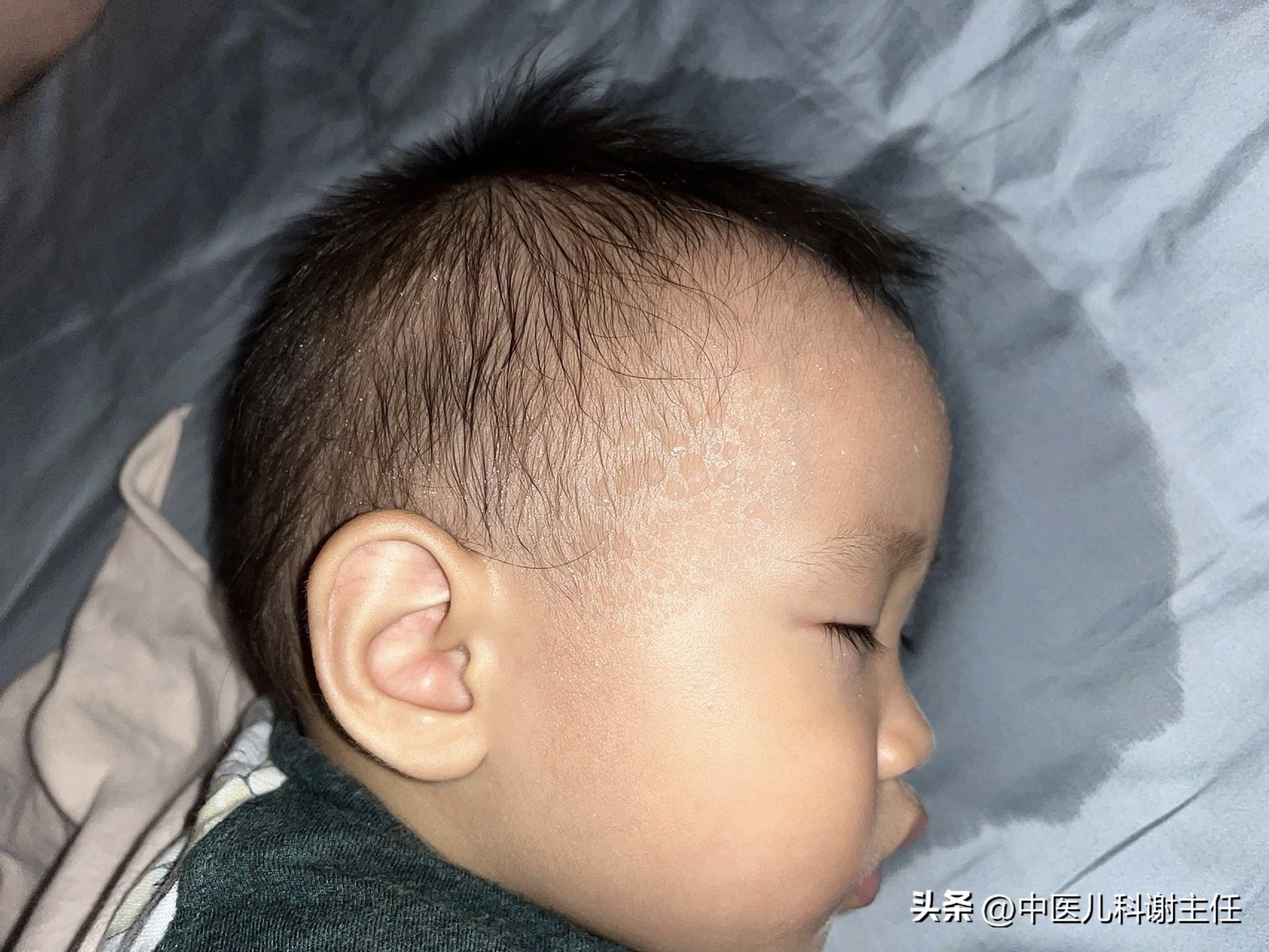 家有脾虚宝宝的，赶紧收藏这份脾胃养护干货，很难找到这么全的！