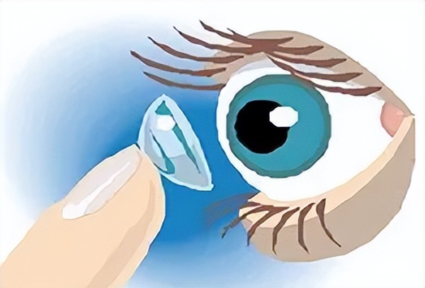 眼科集采政策利好还是利空,广西眼科晶体集采最新消息