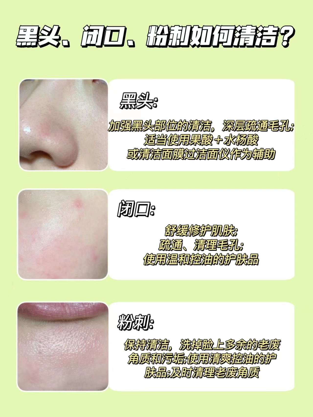 自然堂果酸面膜有什么功效,自然堂果酸面膜正确使用方法