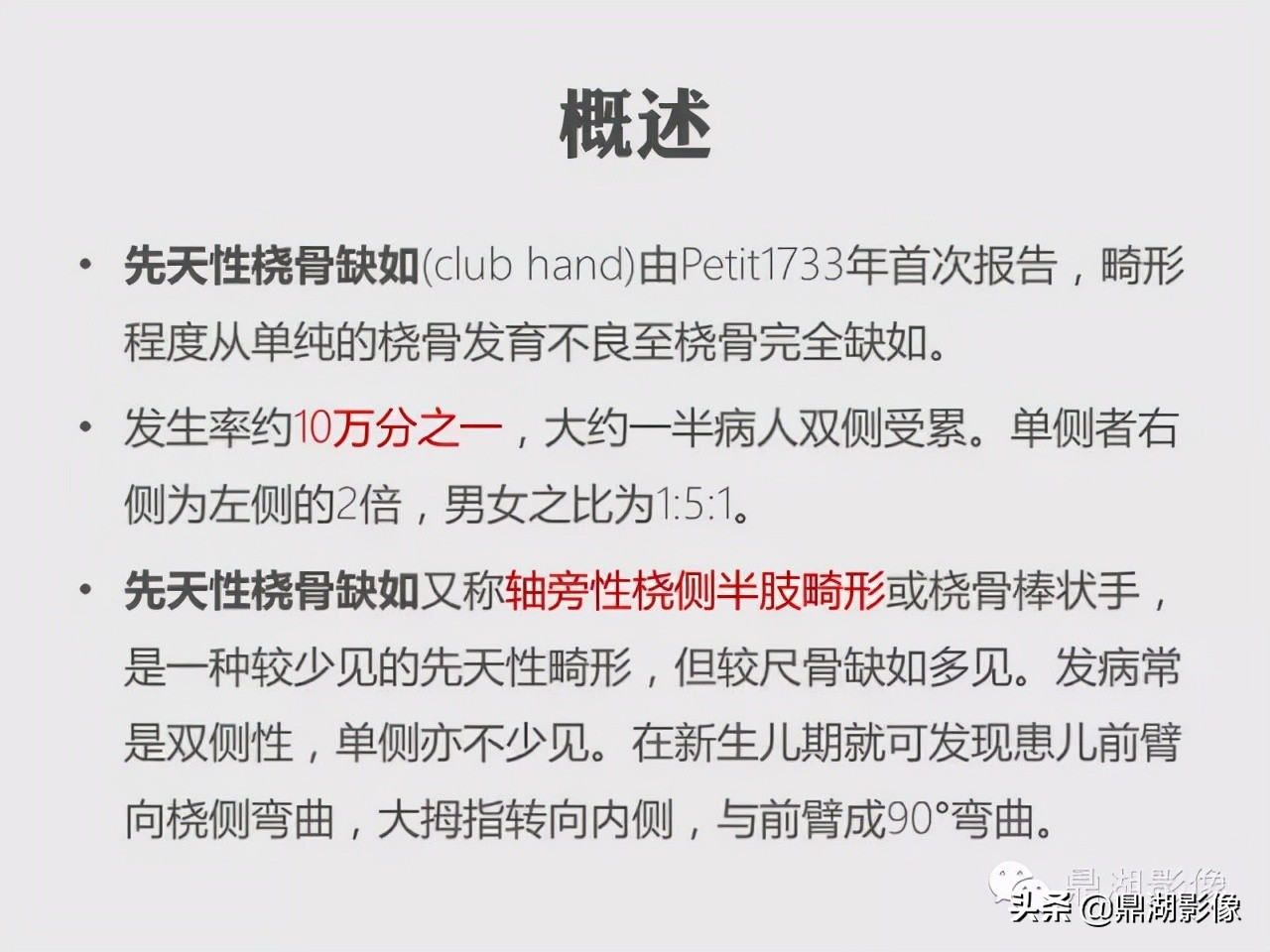 先天桡骨缺失畸形能治疗吗,先天性桡骨发育不良