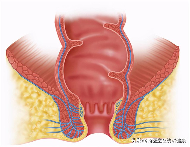 肛瘘不想手术怎么办,为什么肛瘘手术后才是痛苦的开始