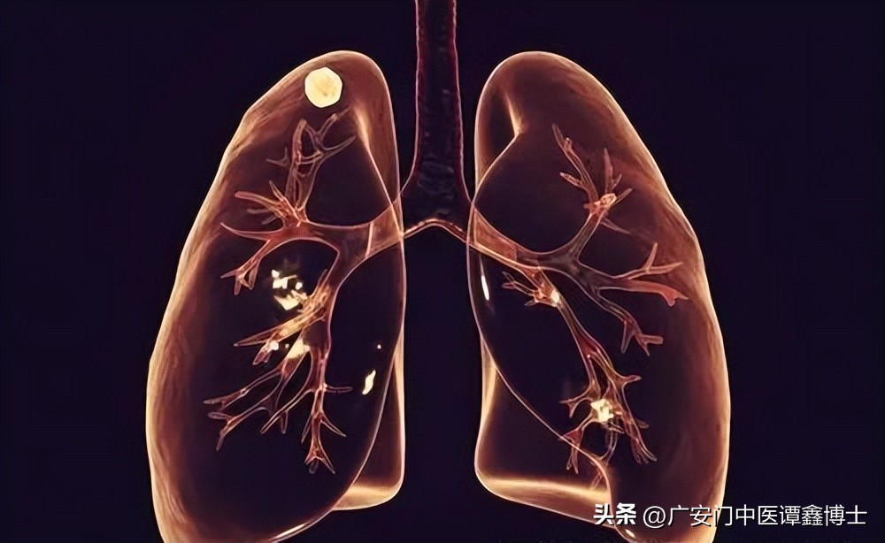 肺部肿瘤增大快属于什么类型肺癌,肺部肿瘤和肺癌的区别和危害