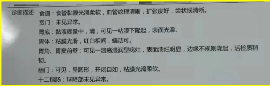 初学者怎样学习胃镜的操作手法,胃镜怎么做的过程图片解说