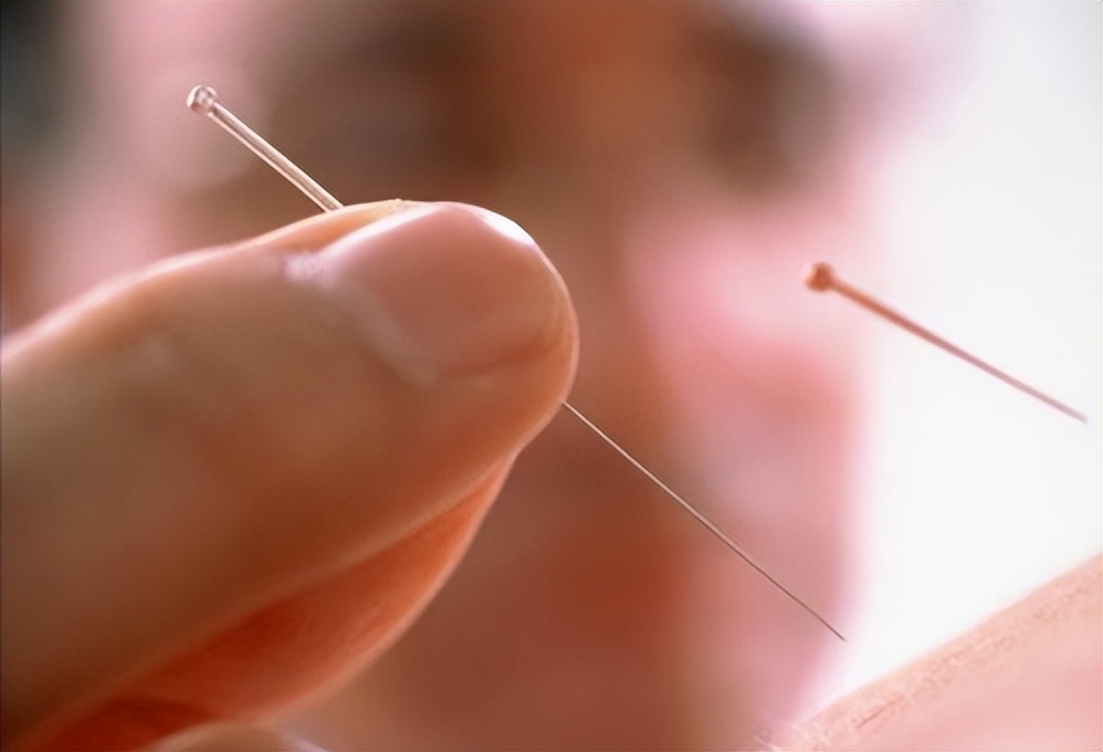 针灸临床经验选编精华,古法针灸临床治验