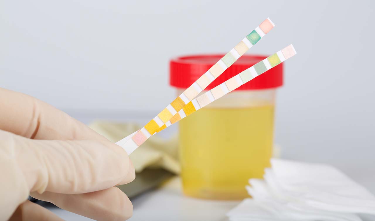 上午尿液颜色深下午尿液颜色无色,尿液颜色像菊花茶的颜色