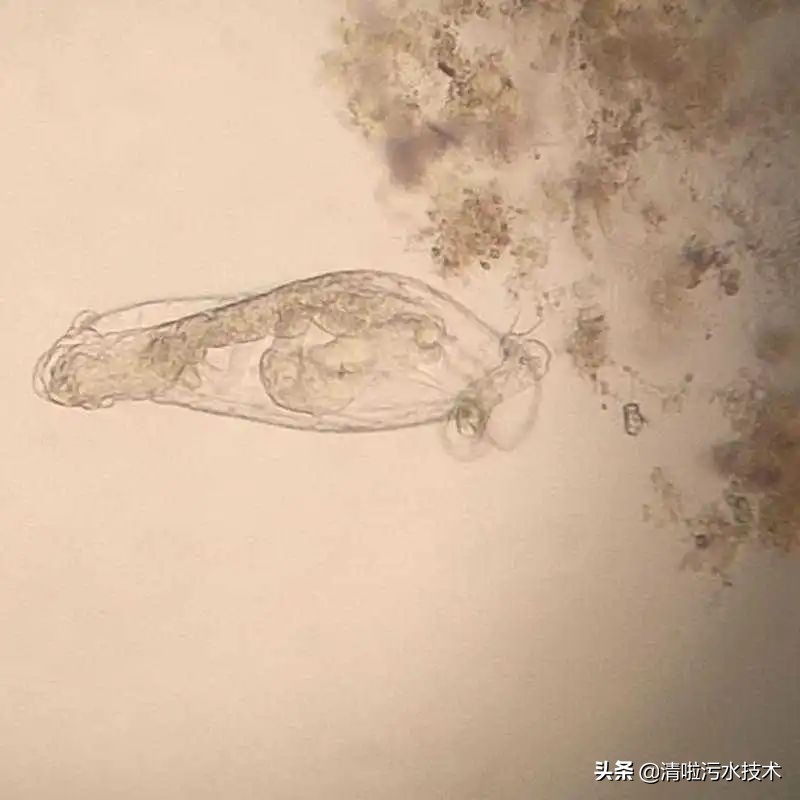 微生物镜检用什么试剂,微生物镜检表