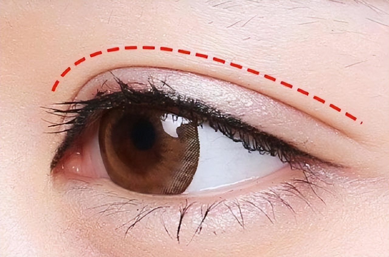 做双眼皮真相,做双眼皮要了解的问题