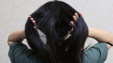 哪些因素会导致秃发,怎样可以停止斑秃继续掉发