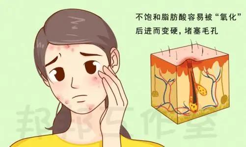 痘痘总是不消下去泛红怎么回事,痘痘总是凸起消不下去怎么办