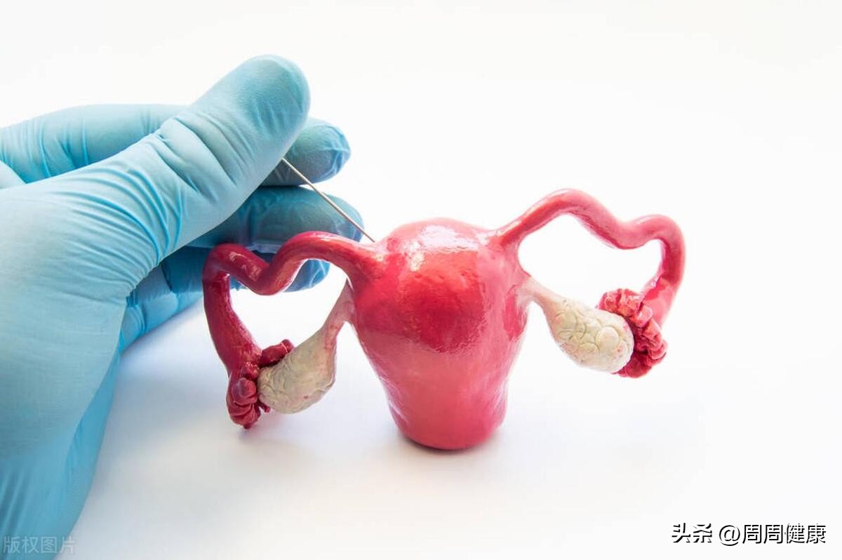 盆腔炎的症状及治疗方法,盆腔炎症状和治疗方法是什么
