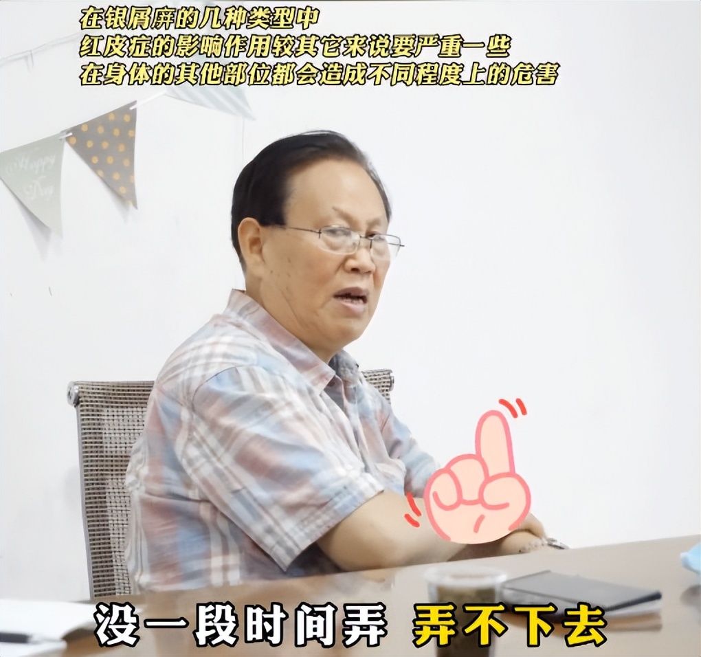 公路领导红皮型银屑病拒绝住院，何教授迎难而上：治就治