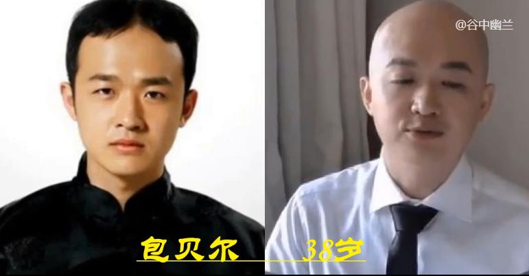 郭冬临头发变化史,郭冬临以前有头发现在光头