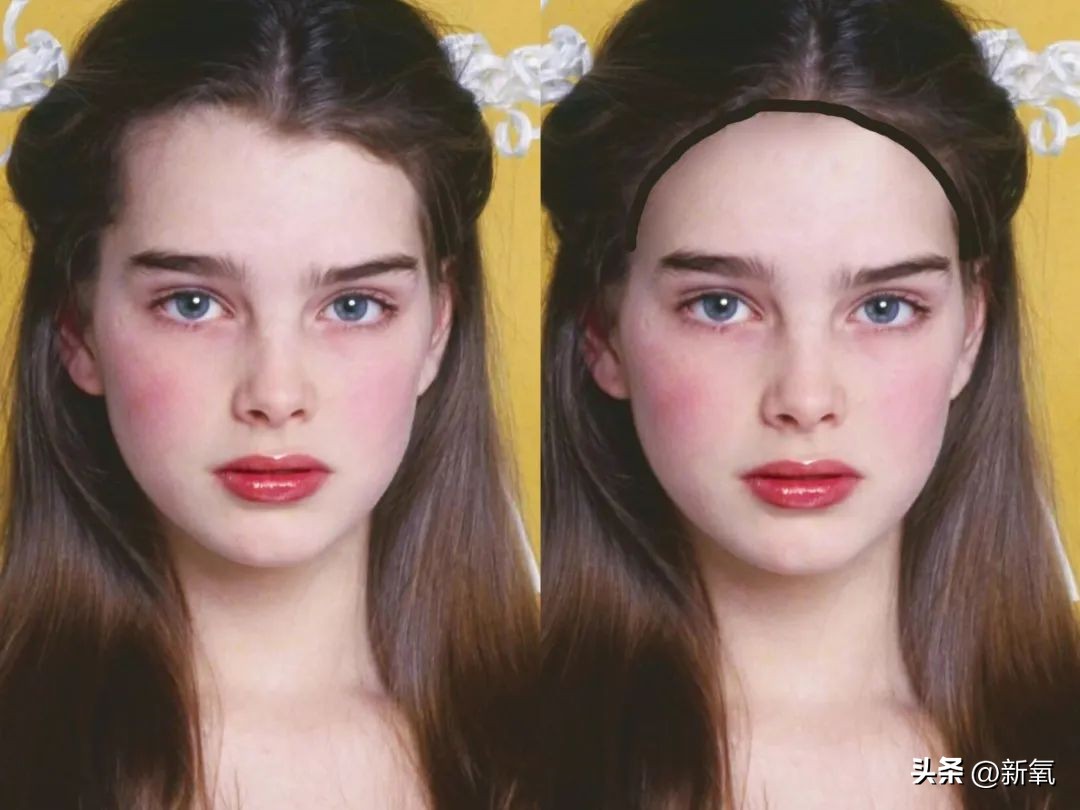 高颅顶怎么掩饰发际线,高颅顶会显得发际线低吗