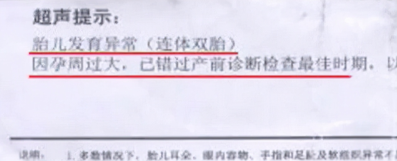 中国首例双头婴儿现状如何,全国首例双头婴儿现在咋样了