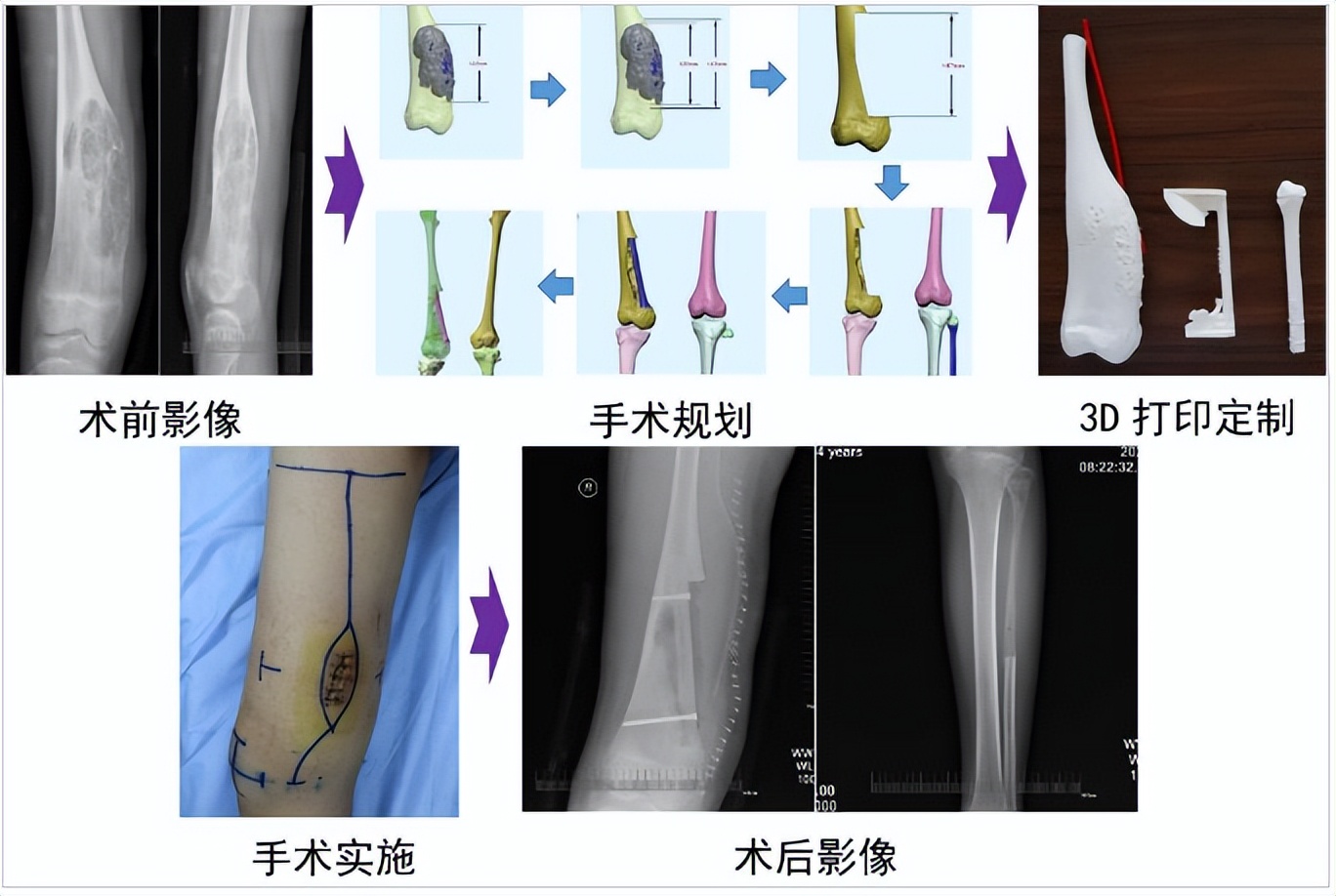 985高校揭牌4个重磅科研平台,辽宁省肿瘤医院有建分院的消息吗