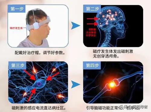 焦虑症抑郁症走向康复的四大步骤,抑郁症焦虑康复的过程
