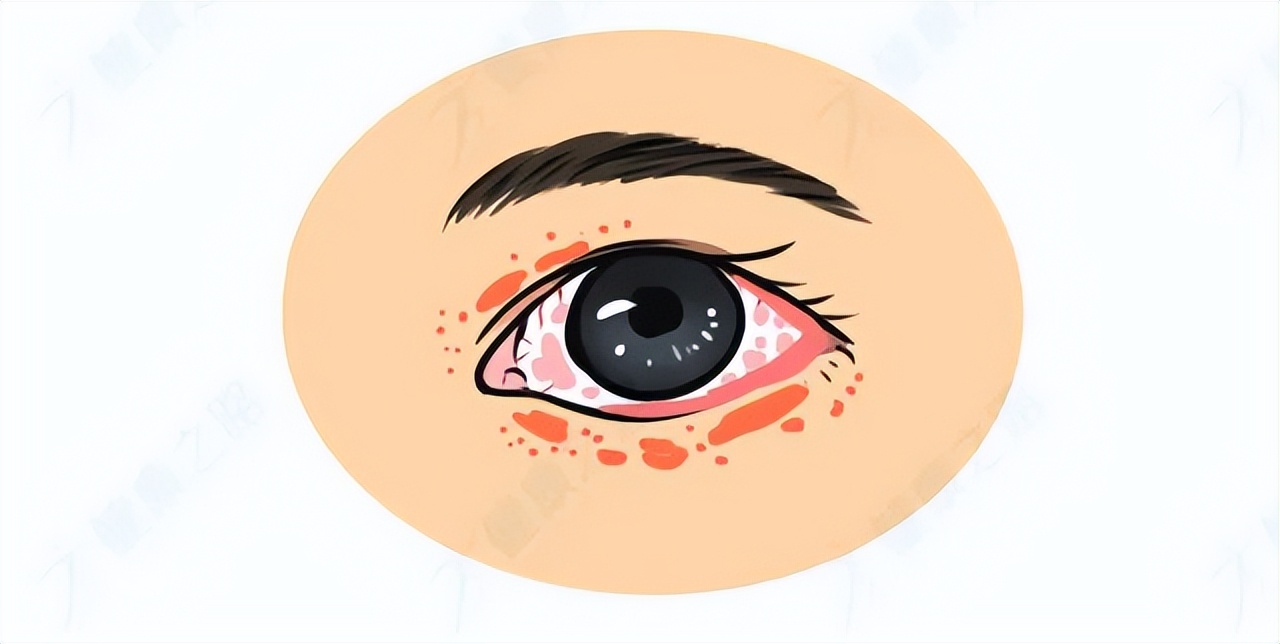 眼药水不能乱用小心伤眼睛,眼药水禁用品牌