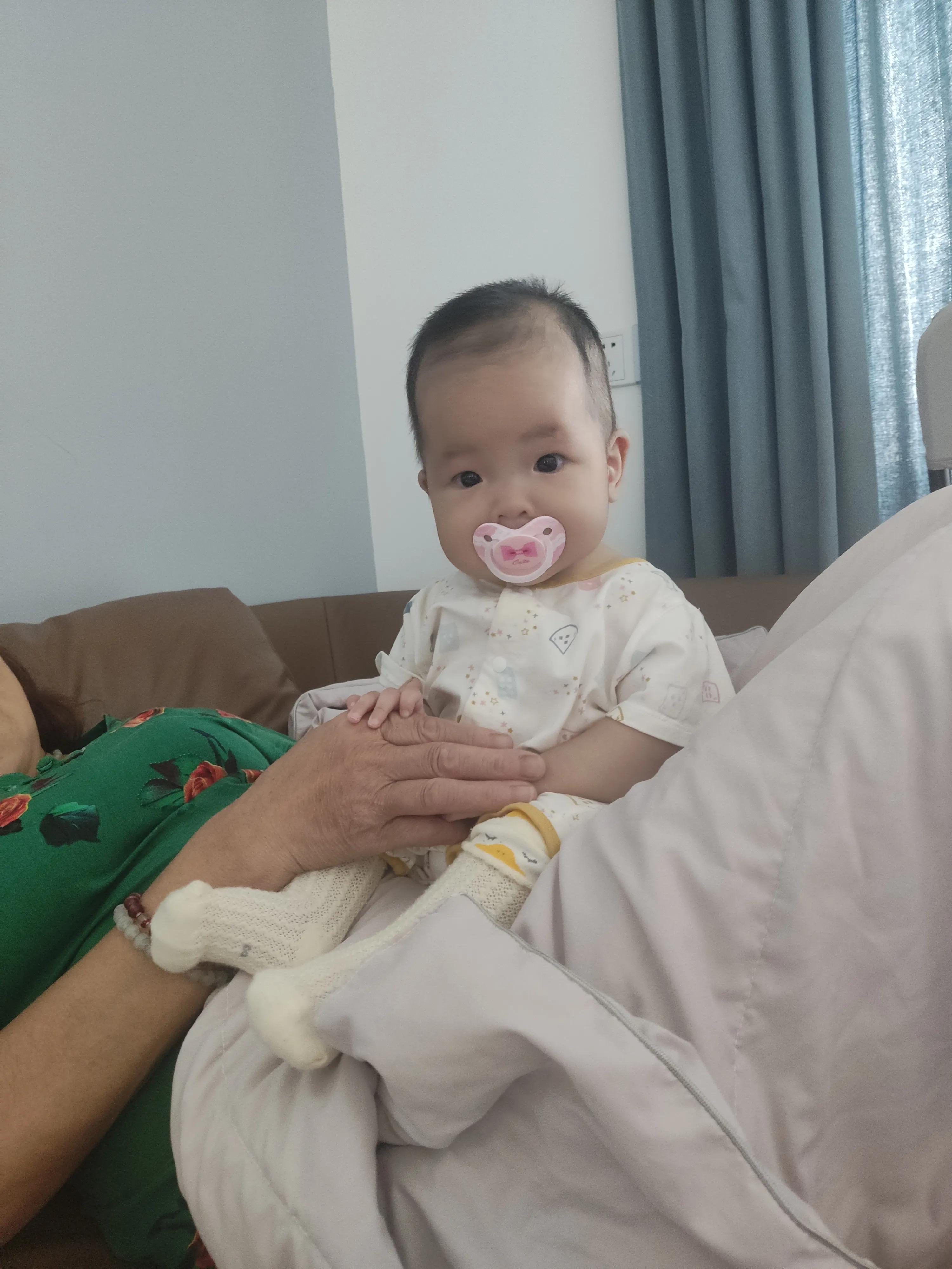 婴儿牛奶蛋白过敏最快解决办法,婴儿蛋白过敏怎么转奶