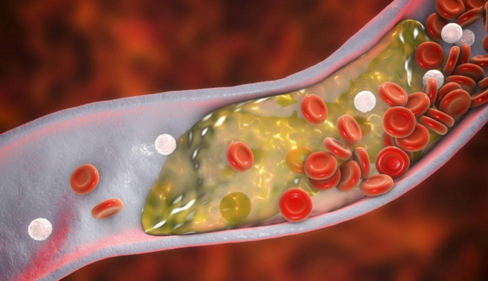 *013院医**教授：少吃点肉吧！太多人因它而受罪，是时候醒悟了