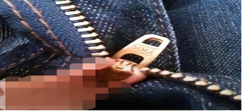 “丁头”发“炎”怎么办？—氦氖激光照射治疗为您排忧解“男”