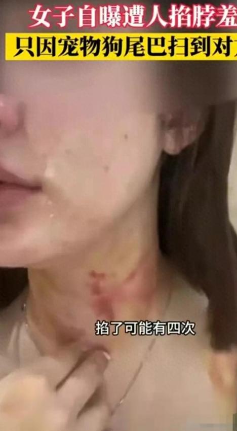闹大了！电梯内狗尾巴扫腿，23岁女子在打斗中被扯下衣服！真惨烈