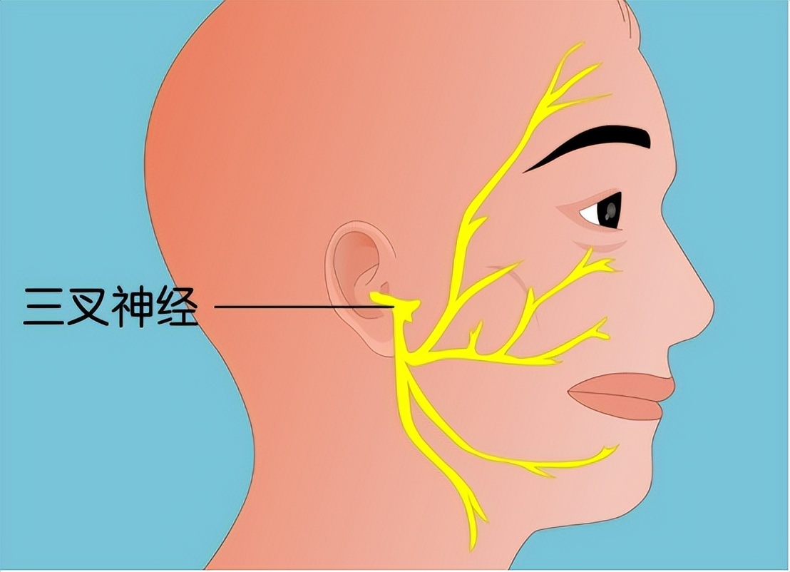 原发性三叉神经痛有治好的吗,原发性三叉神经痛怎么治疗有效