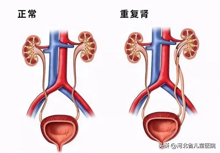 宝宝裤子总是湿湿的,三岁宝宝尿尿前裤子总是湿一点