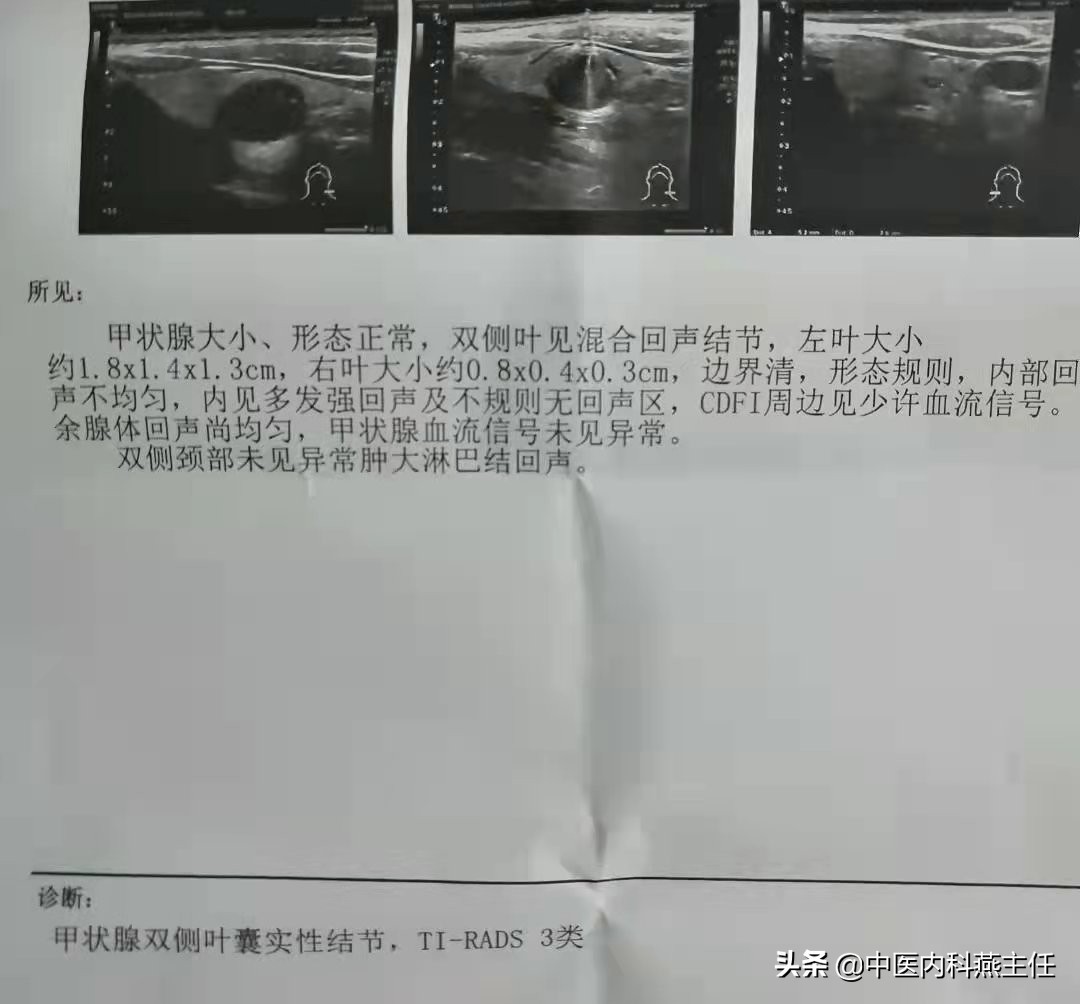 调理结节囊肿的名医,治结节囊肿的16味中药图片