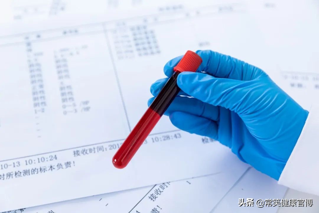 丙肝治愈后还会被传染丙肝吗,丙肝怎么传染给别人