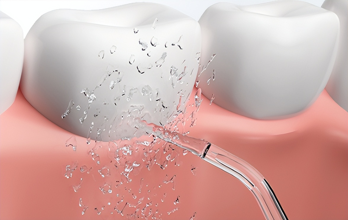 冲牙器对口腔有什么危害,冲牙器的副作用和危害排行榜