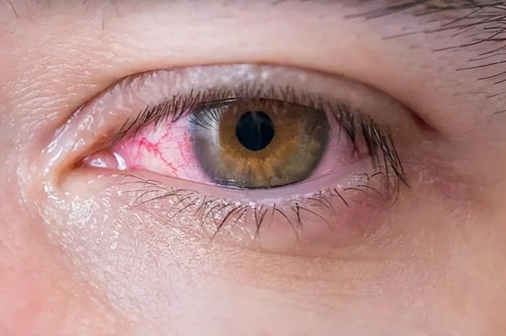 每天吃大蒜的人最后得到了什么,每天吃大蒜的好处和坏处